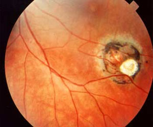   مصر اليوم - اكتشاف بروتين جديد قد يساعد في علاج داء المقوسات والملاريا