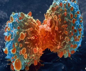   مصر اليوم - إعاقة بروتين MCL-1 تقضي على الخلايا السرطانية