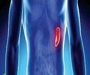   مصر اليوم - أميركا تطور أول طحال إصطناعى فى العالم