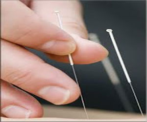   مصر اليوم - خضع لجراحة في الركبتين فخرج من دون سنّتين