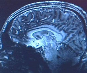   مصر اليوم - وزارة الصحة اليابانية تراجع مشروعًا بحثيًا عن مرض ألزهايمر