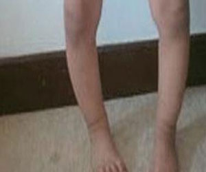   مصر اليوم - فيتامين د لحماية الجسم من لين العظام والتهاب المفاصل