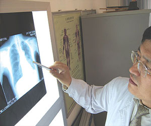   مصر اليوم - تراجع معدلات الإصابة بسرطان الرئة بين الرجال والسيدات في أميركا