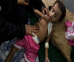   مصر اليوم - 10.5 مليون يمني يعانون من انعدام الأمن الغذائي