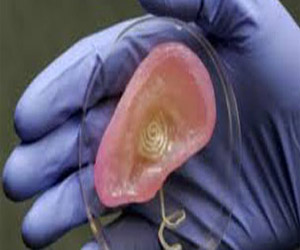   مصر اليوم - الأذن الصناعية ذات الأبعاد الثلاثية أحدث الاختراعات