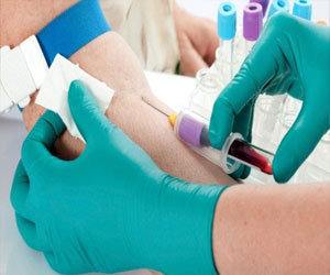   مصر اليوم - التهاب الكبد الوبائي الصامت في نيجيريا