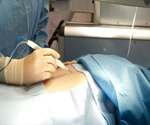 مصر اليوم - أحدث الاختراعات مشرط لاكتشاف الخلايا السرطانية