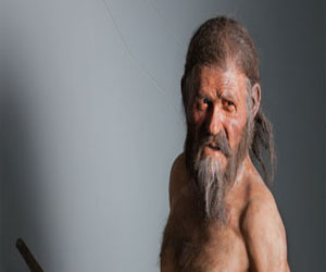   مصر اليوم - تسوس الأسنان ظهر فى العصر الحجرى مع تعرف الإنسان على الزراعة