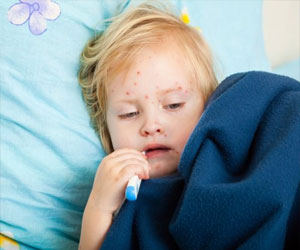   مصر اليوم - رضيع الحصبة المعدي يثير الذعر في نيوزيلاندا