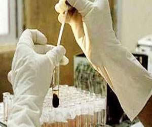   مصر اليوم - الصحة: لا زيادةفى أعداد مصابي فيروس الإنفلوانزا