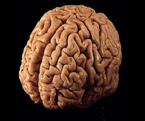   مصر اليوم - دراسات عن التحورات الجينية تلقى ضوءًا جديدًا على الفصام