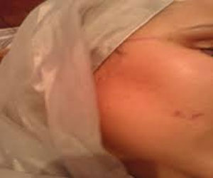   مصر اليوم - أستاذة تتعرّض لاعتداء من أمّ تلميذة