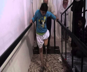   مصر اليوم - أطبّاء سوريُّون في المهجر ينشؤون المشروع الوطنيّ للأطراف الصناعيَّة