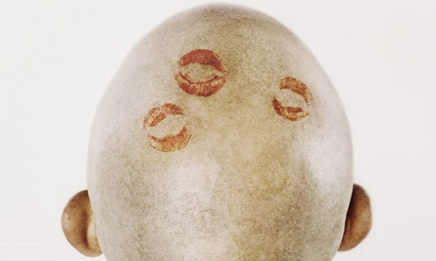   مصر اليوم - علماء يخترعون علاجًا يقضي على ''الصلع'' نهائيًا