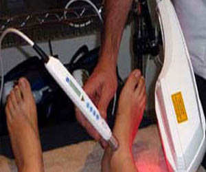   مصر اليوم - الوخز بأشعة الليزر أحدث الصيحات العلاجية لالتهاب المفاصل