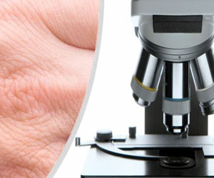   مصر اليوم - مركز متطور لزراعة جلد الإنسان و إنباته في سيبيريا