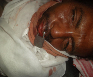 مصر اليوم - عامل يغلق فمه بقفل حديدي لإزالة كشكه في جنوب الأقصر