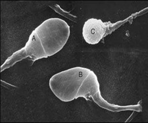   مصر اليوم - اكتشاف جين مرتبط بالعقم عند الرجال