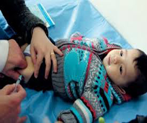   مصر اليوم - 79 حالة مصابة بالحصبة في النمسا خلال العام الماضي