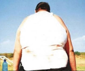   مصر اليوم - السمناء المصابون بسرطان اللسان أكثر عرضة للوفاة