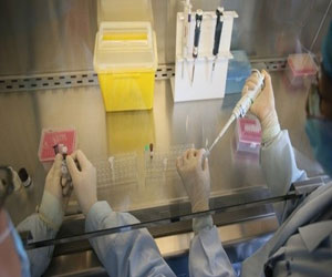   مصر اليوم - اصابة سيدة في العقد الخامس في كفر الشيخ بأعراض انفلونزا الخنازير