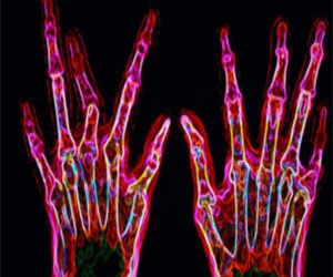   مصر اليوم - تطبيق جديد يُساعد الأطباء في تحسين استخدام الأشعة السِّينيَّة