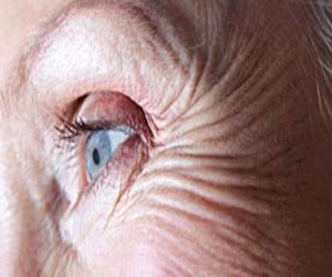 مصر اليوم - المشاكل العاطفية تسبب تجاعيد البشرة للمرأة