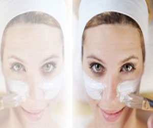   مصر اليوم - طرق الاهتمام بالبشرة لمنع الحبوب