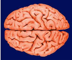 مصر اليوم - الرجال يتفوقون على النساء في حجم أدمغتهم