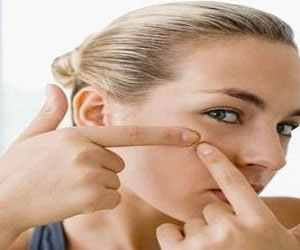   مصر اليوم - نصائح للتخلص من البثور و الرؤوس السوداء