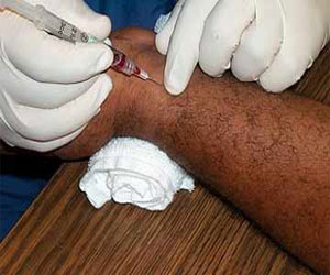   مصر اليوم - فحص دم دون وخز إبر