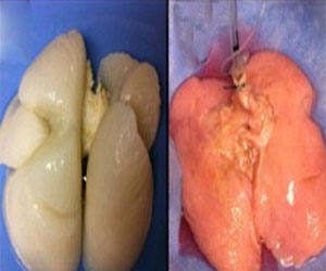   مصر اليوم - خبراء أميركيون ينتجون رئة إنسان اصطناعيَّة