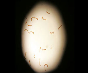   مصر اليوم - دواء بيطرى يثبت فاعليته في التخلص من الديدان لدى الأطفال