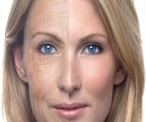   مصر اليوم - جلسات الكهرباء الحل النهائى لإزالة تجاعيد البشرة