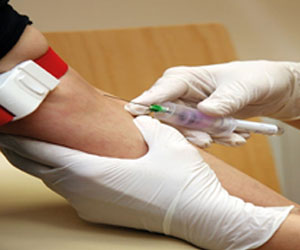   مصر اليوم - دراسة : لزوجة الدم أحد الأعراض الجانبية الخطيرة لنقص الحديد