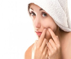   مصر اليوم - نصائح للحد من الإصابة بالإكزيما الدهنية