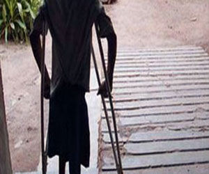   مصر اليوم - ظهور أول حالة إصابة بشلل الأطفال في كابول منذ عام 2001