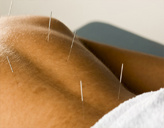   مصر اليوم - الأبحاث الأميركيّة تؤكّد فاعليّة الوخز بالإبر الصينيّة