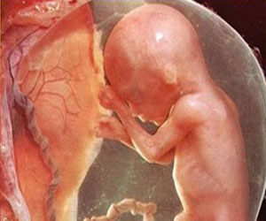   مصر اليوم - الموجات الصوتية تعمل علي فحص قلب الطفل داخل الرحم