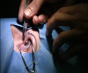   مصر اليوم - أورمان سوهاج تجري عمليات عيون لـ250 مريضًا شهريًّا