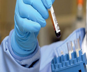   مصر اليوم - لقاح الأنفلونزا يحمى من الجلطة القلبية