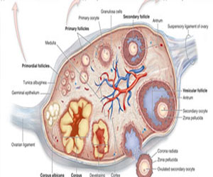   مصر اليوم - السمنة تزيد من خطر إصابة سرطان المبيض