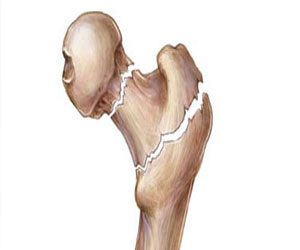   مصر اليوم - تناول القهوة يحد من خطر الإصابة بطنين الأذن