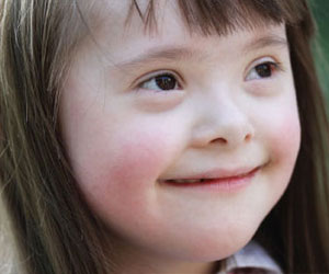   مصر اليوم - 1800 حالة إصابة بمتلازمة داون في الكويت