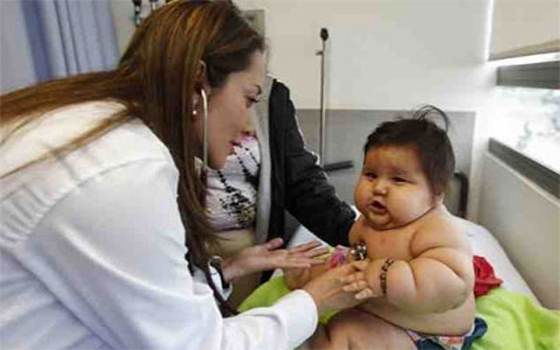   مصر اليوم - مُؤسَّسة خيريَّة تُنقذ طفل كولومبيا البدين