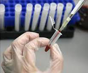   مصر اليوم - تطوير خلايا جذعية من قطرة دم واحدة