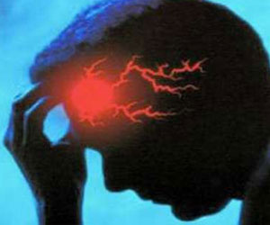   مصر اليوم - السكتة الدماغية يمكن أن تصيب صغار السن أيضاً