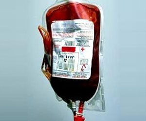   مصر اليوم - علماء أمريكيون يطورون تطبيقًا جديدًا لتحليل الدم لمرضى السيولة