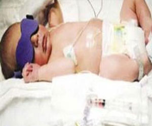   مصر اليوم - الأطفال الخدّج يواجهون مشاكل في الرياضيات