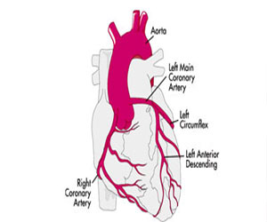   مصر اليوم - توسيع الشرايين من أنواع جراحات القلب